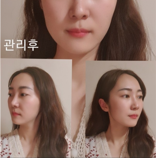 [강남/논현] 뼈쌤체형교정원